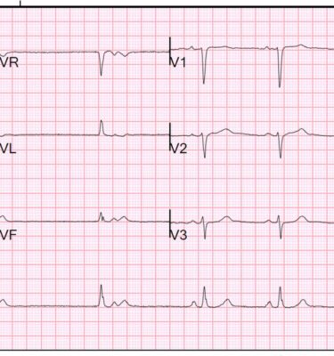 EKG Course